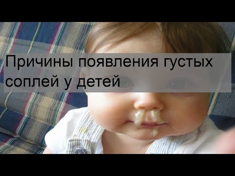 Причины появления густых соплей у детей