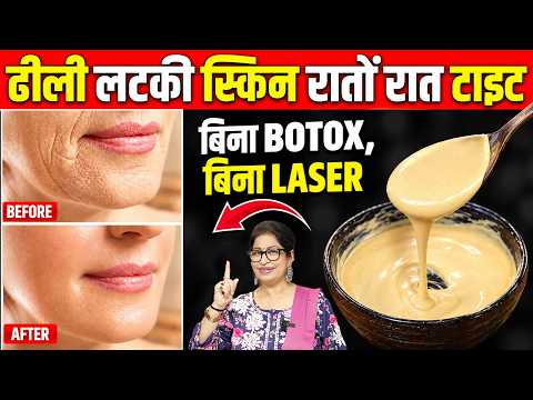 ढीली लटकी स्किन में डालें एक नई जान - बिना Botox, बिना Laser | Home Remedies For Skin Tightening