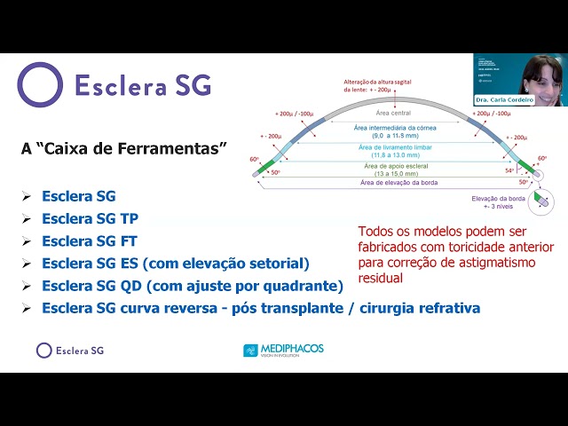 Webinar: Como Otimizar Suas Adaptações em Lentes Esclerais - 30/01/2024