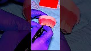endo-resto conclave by endodontic excellence society | Dr. Jyoti Agarwal #endodontics