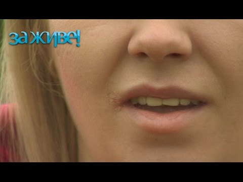 Вопрос: Как побороть проблему потрескавшихся губ?