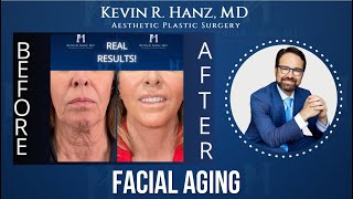 The Real Reason Your Face Looks Different | Plastic Surgeon Reveals screenshot 1