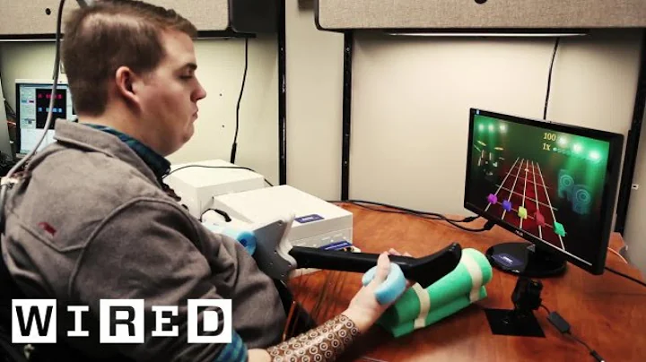 A Brain Implant Brings a Quadriplegics Arm Back to...