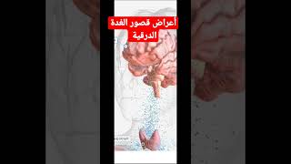 أعراض قصور الغدة الدرقية