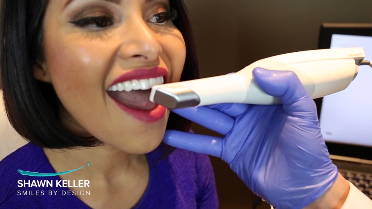 The Trios Scanner Provides Precision 3D Scan of Your Teeth.