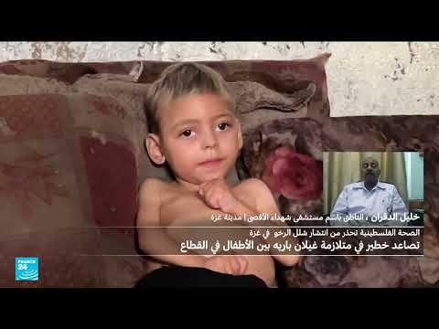 تدهور الوضع الصحي وسوء التغذية في غزة: ارتفاع الوفيات بين الأطفال