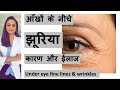 झुर्रियों  के कारण, बचाव और ईलाज । Treatment of fine lines and wrinkles | त्वचा के डॉक्टर