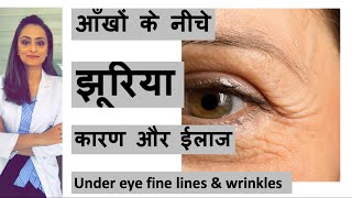 झुर्रियों  के कारण, बचाव और ईलाज । Treatment of fine lines and wrinkles | त्वचा के डॉक्टर