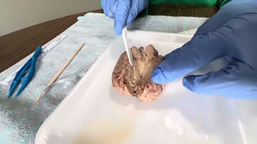 Sheep Brain Dissection P2