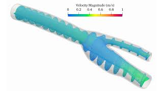 Carotid flow by SPHinXsys.