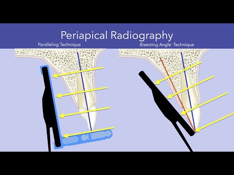 Intraoral Radiologic Imaging