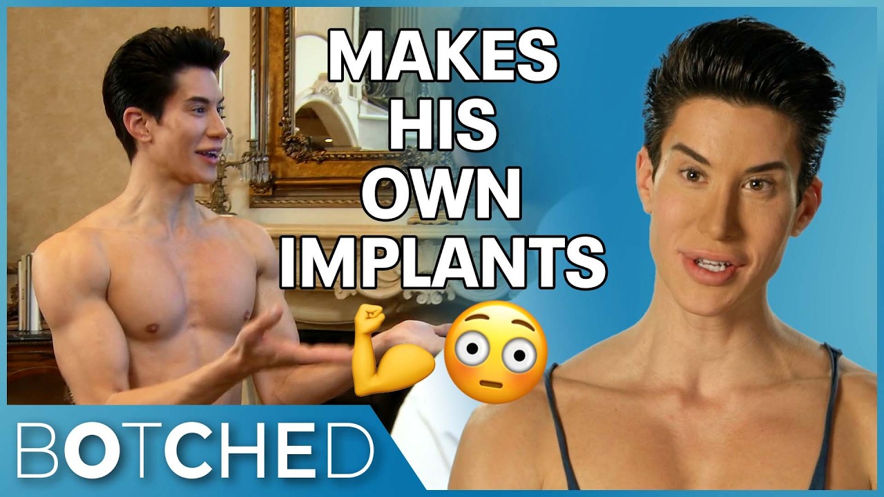 The Human Ken Doll is Both Frankenstein and Monster | Rejected By Botched | E!