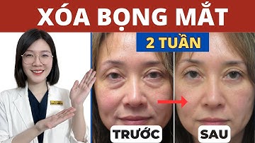 Massage 3 Phút mỗi ngày XÓA BỌNG MẮT sau 2 TUẦN | Thạc sĩ - Bác sĩ Phương Quý