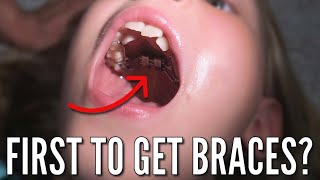 Finally, Someone is Getting Braces...and Separators, and an Expander! | Who Is the Lucky One?? by Life As We GOmez 90,256 views 5 days ago 21 minutes