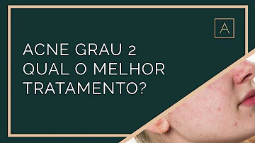 Qual tratamento para acne grau 2?