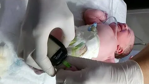 Cute Newborn Baby First Assessment in Labor Room | Oxygen Support, RBS Check & NICU Car