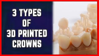 🦷 3 Types of Crowns You Can Create With a 3D Printer