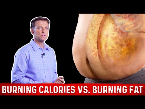 Burning Calories vs. Burning FAT Calories? – Dr. Berg