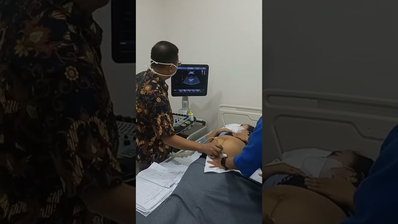 dr M SITORUS SpOG - RSIA dr DJOKO PRAMONO KARAWANG - USG TERAKHIR SEBELUM MELAHIRKAN ANAK KEDUA