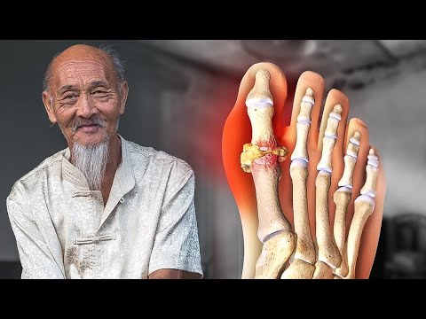 Старый китаец рассказал как чайный гриб влияет на подагру и почки