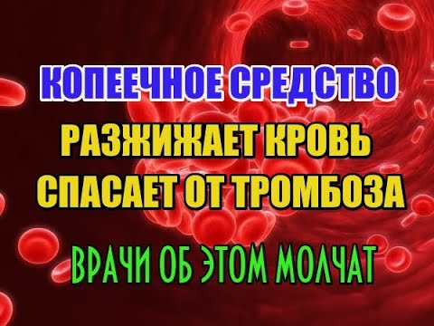 КОПЕЕЧНОЕ СРЕДСТВО ОТ ТРОМБОЗА И ПОВЫШЕННОГО ФИБРИНОГЕНА. РАЗЖИЖАЕТ КРОВЬ