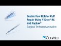 Double row rotator cuff repair using yknot rc and poplok  conmed animation