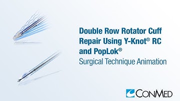 Double Row Rotator Cuff Repair Using Y-Knot® RC and PopLok® - CONMED Animation