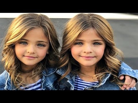 Video: Mehrfarbige Britische Zwillinge Sind 7 Jahre Alt - Alternative Ansicht