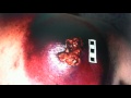 Christians, Cancer in The Body of Christ Needs 2B Exposed, & Removed 4 the rest of the Body 2 Live