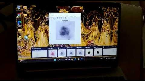 skin cancer detection using deep learning technique.