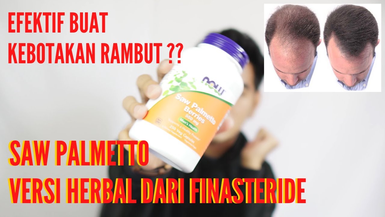 Can You Take Saw Palmetto With Finasteride SAW PALMETTO (VERSI HERBAL FINASTERIDE) - YouTube