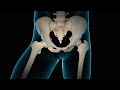 Minimally invasive total hip replacement  thr  nucleus health