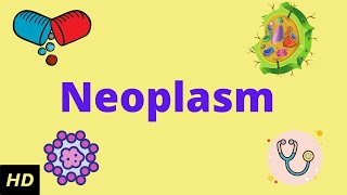 Neoplasm, Causes, Signs and Symptoms, Diagnosis and Treatment.