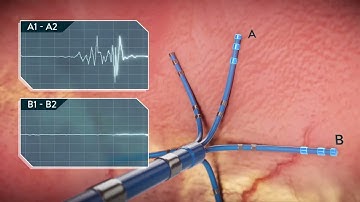 Cardiac Electrophysiology Systems | Trailer | Biomedical Engineers TV |