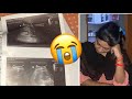 Doctor ne ultrasound kya bata diya mehwish family vlogs