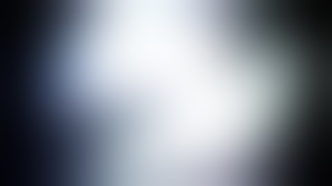 Video-assisted Thoracoscopic Resection of a Small Pulmonary Nodule after Computed Tomography--guided