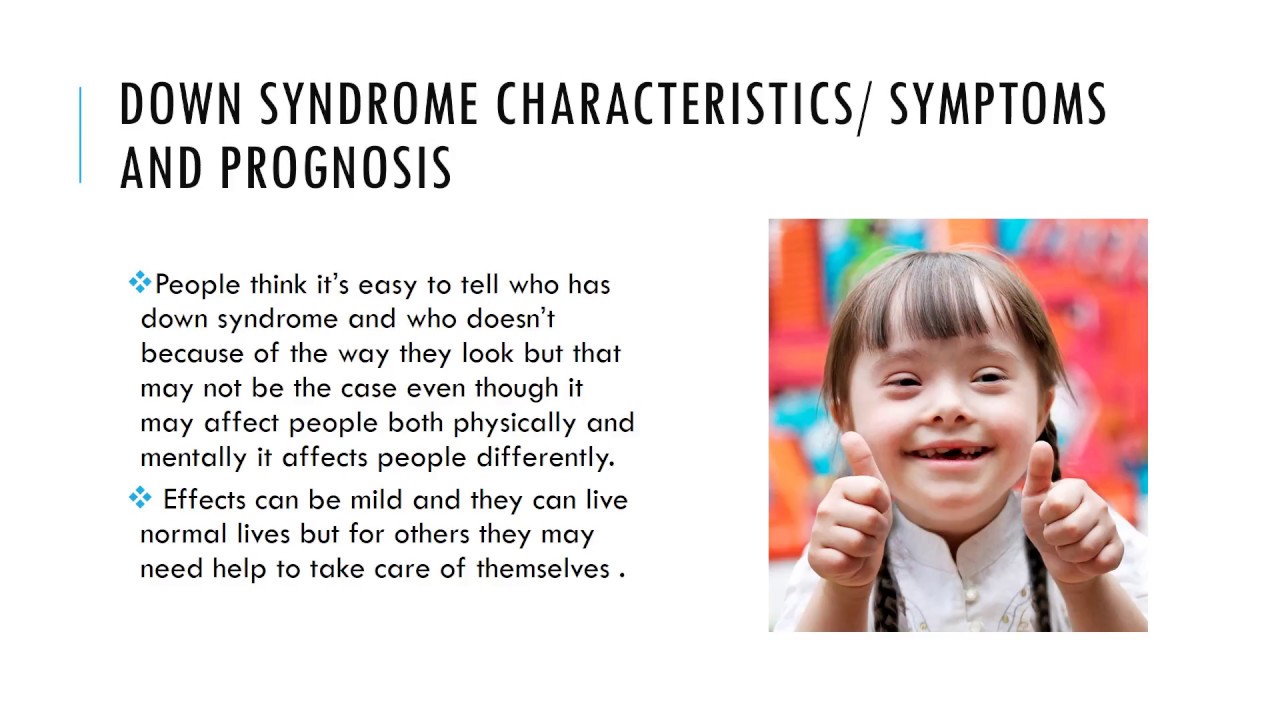 Down Syndrome Presentation.