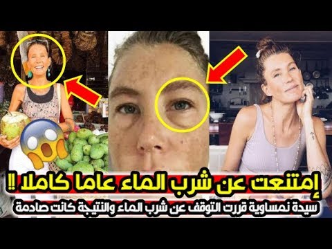 فيديو: شربت صوفي عصائر الفاكهة بدلاً من الماء لمدة عام. عرضت الفتاة صورة لكيفية تغير وجهها