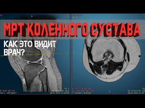 Видео: Колко снимки можете да поставите на Zoosk?