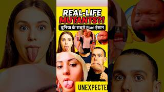Who Are The World’s Most Rare People? | Rare Humans Facts | Unbelievable Real Stories 😱” | #shorts