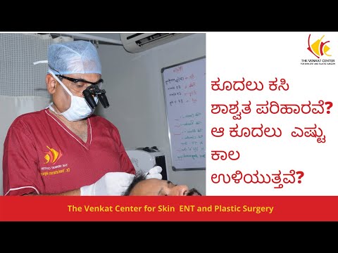 ಕೂದಲು ಕಸಿ  ಶಾಶ್ವತ ಪರಿಹಾರವೆ? ಆ ಕೂದಲು  ಎಷ್ಟು ಕಾಲ ಉಳಿಯುತ್ತವೆ?