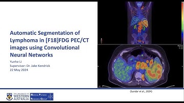 Yunhe Li: Segmentation of Lymphoma in PET/CT images