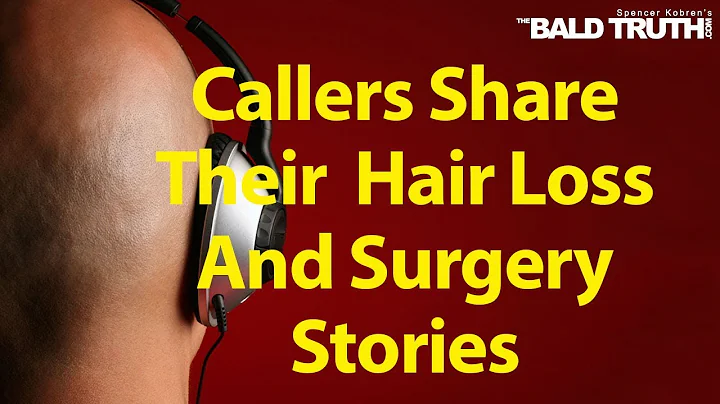 The Bald Truth for Tuesday Oct. 1st, 2019 - Personal Stories, Hair Loss Hair Transplants