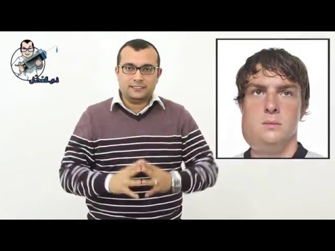 في العضل | النكاف - التهاب الغدة النكافية - Mumps - أبو اللكيم