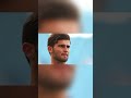 Shaheen Afridi njury A Warning Sign