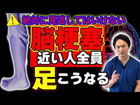 脳梗塞を遠ざける!足の違和感チェックと今すぐできる予防法 10秒運動