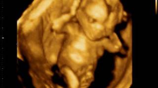 Echographie 3d A 4 Mois De Grossesse Pour Les Jeune Maman Blog De Spi867 Echographie 3d A 4 Mois De Grossesse Pour Les Jeune Maman Blog De Spi867