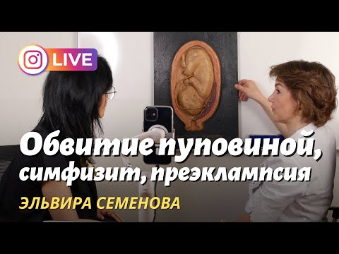Предлежание плаценты, обвитие