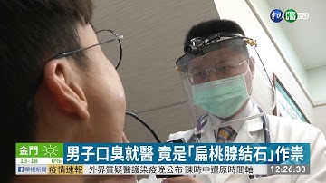 男子口臭就醫 竟是｢扁桃腺結石｣作祟｜華視新聞 20210114