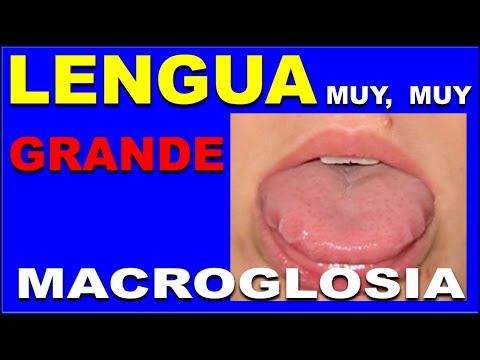 Vídeo: Quant de temps es necessita per fer créixer una barbeta? Accelereu el creixement del cabell facial